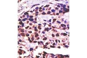 Image no. 2 for anti-Ubiquitin Specific Peptidase 25 (USP25) (C-Term) antibody (ABIN357563) (USP25 抗体  (C-Term))