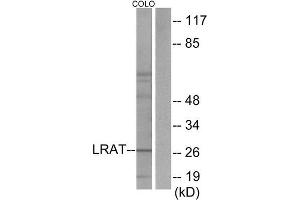 Western Blotting (WB) image for anti-Lecithin Retinol Acyltransferase (Phosphatidylcholine--Retinol O-Acyltransferase) (LRAT) (Internal Region) antibody (ABIN1849061) (LRAT 抗体  (Internal Region))