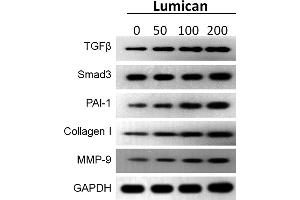 Western Blotting (WB) image for anti-Matrix Metallopeptidase 9 (Gelatinase B, 92kDa Gelatinase, 92kDa Type IV Collagenase) (MMP9) (AA 538-707) antibody (ABIN6143920)