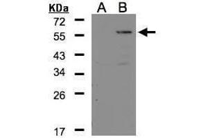 WB Image Western Blot analysis of CPE expression in transfected 293T cell line by CPE polyclonal antibody. (CPE 抗体)