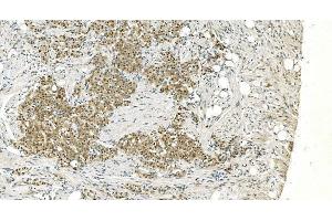 IHC analysis of LSM5 using anti-LSM5 antibody (ABIN7602503).