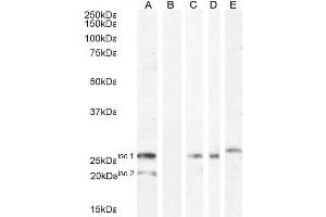 ABIN334524 (1ug/ml) staining of HEK293 iso 1 + iso 2 cell lysate (A) + peptide (B). (VTCN1 抗体  (Internal Region))