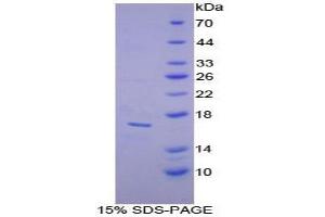 SDS-PAGE analysis of Mouse alpha Lactalbumin Protein. (LALBA 蛋白)