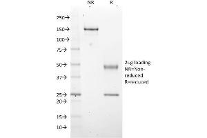 SDS-PAGE Analysis Purified EZH2 / KMT6 Mouse Monoclonal Antibody (EZH2/2536). (EZH2 抗体)