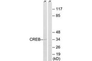 Western blot analysis of extracts from Jurkat cells, using CREB (Ab-100) Antibody. (CREB1 抗体  (AA 71-120))