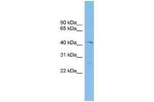 WB Suggested Anti-ETV7 Antibody Titration: 0. (ETV7 抗体  (N-Term))