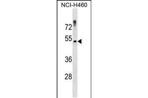 Western blot analysis in NCI-H460 cell line lysates (35ug/lane). (RHCG 抗体  (AA 184-213))