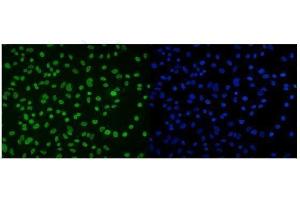 IF analysis of DDX5 using anti-DDX5 antibody (ABIN7602561). (DDX5 抗体  (AA 85-328))