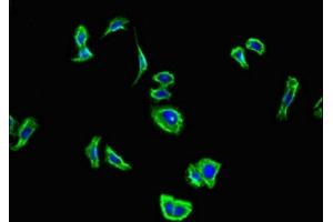 Immunofluorescent analysis of HepG2 cells using ABIN7146648 at dilution of 1:100 and Alexa Fluor 488-congugated AffiniPure Goat Anti-Rabbit IgG(H+L) (CNR2 抗体  (AA 305-360))