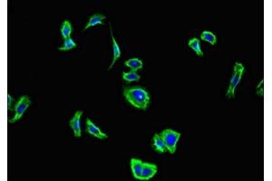 Immunofluorescent analysis of HepG2 cells using ABIN7146648 at dilution of 1:100 and Alexa Fluor 488-congugated AffiniPure Goat Anti-Rabbit IgG(H+L) (CNR2 抗体  (AA 305-360))