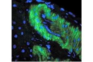 Image no. 1 for anti-Nitrotyrosine antibody (ABIN466935) (Nitrotyrosine 抗体)