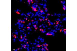 Immunofluorescence (Paraffin-embedded Sections) (IF (p)) image for anti-Mitochondrially Encoded NADH Dehydrogenase 5 (MT-ND5) antibody (ABIN7074659)
