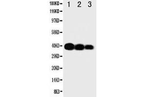 Western Blotting (WB) image for anti-Interleukin 12 beta (IL12B) (AA 23-40), (N-Term) antibody (ABIN3043199) (IL12B 抗体  (N-Term))