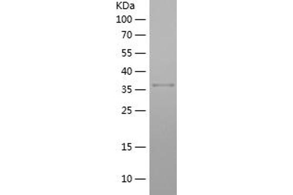 HNRNPA3 Protein (AA 210-345) (His-IF2DI Tag)