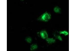 Anti-ANKRD53 mouse monoclonal antibody (ABIN2454354) immunofluorescent staining of COS7 cells transiently transfected by pCMV6-ENTRY ANKRD53 (RC206701). (ANKRD53 抗体  (AA 1-300))