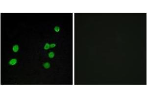 Immunofluorescence analysis of MCF7 cells, using p97 MAPK Antibody. (MAPK6 抗体  (AA 461-510))