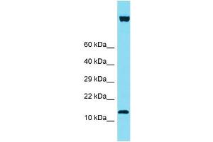 Western Blotting (WB) image for anti-IQ Motif Containing F6 (IQCF6) (C-Term) antibody (ABIN2774552) (IQCF6 抗体  (C-Term))