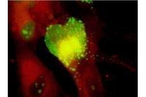 ELISA image for anti-Cytomegalovirus p65 (CMV p65) antibody (ABIN265536) (CMV p65 抗体)