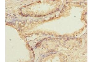 Immunohistochemistry (IHC) image for anti-General Transcription Factor IIA, 2, 12kDa (GTF2A2) (AA 1-109) antibody (ABIN7172660)