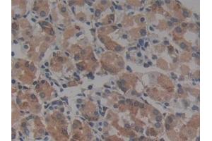 Immunohistochemistry (IHC) image for anti-Angiotensin I Converting Enzyme (Peptidyl-Dipeptidase A) 1 (ACE) (AA 1160-1306) antibody (ABIN7442498)