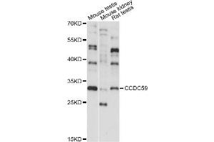 Western blot analysis of extracts of various cell lines, using CCDC59 antibody (ABIN6293275) at 1:1000 dilution. (CCDC59 抗体)