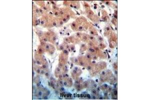 INHBB Antibody (C-term) (ABIN655083 and ABIN2844717) immunohistochemistry analysis in formalin fixed and paraffin embedded human liver tissue followed by peroxidase conjugation of the secondary antibody and DAB staining. (INHBB 抗体  (C-Term))