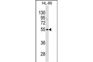 Western blot analysis in HL-60 cell line lysates (35ug/lane). (VIPR1 抗体  (C-Term))