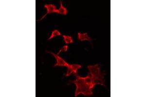 ABIN6268960 staining Hela by IF/ICC. (Stathmin 1 抗体  (N-Term))