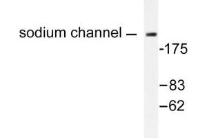 Image no. 1 for anti-Na+ Channel Protein antibody (ABIN271819) (Na+ Channel Protein 抗体)