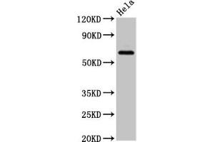 Western Blot Positive WB detected in: Hela whole cell lysate All lanes: SLC22A25 antibody at 6. (SLC22A25 抗体  (AA 31-145))