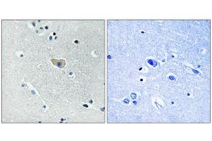NMDAR1 (Phospho-Ser890) antibody reacts with epitope-specific phosphopeptide and corresponding non-phosphopeptide. (GRIN1/NMDAR1 抗体  (pSer890))