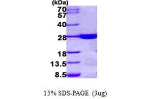 SDS-PAGE (SDS) image for Haloacid Dehalogenase-Like Hydrolase Domain Containing 1 (HDHD1) (AA 1-228) protein (His tag) (ABIN667274)