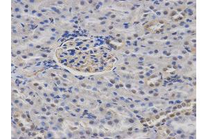 Immunohistochemistry (IHC) image for anti-Calcium/calmodulin-Dependent serine Protein Kinase (MAGUK Family) (CASK) antibody (ABIN1871447) (CASK 抗体)
