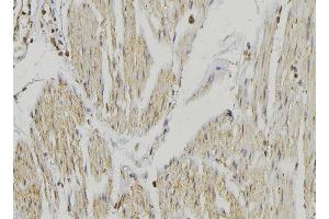 ABIN6274651 at 1/100 staining Mouse muscle tissue by IHC-P. (CYP2R1 抗体  (Internal Region))