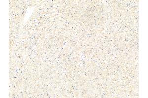 anti-Moloney Leukemia Virus 10 (MOV10) (C-Term) antibody