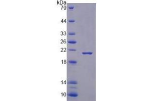 Image no. 1 for RNA Binding Motif Protein 3 (RBM3) (AA 1-157) protein (His tag) (ABIN6237506) (RBM3 Protein (AA 1-157) (His tag))