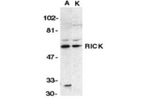 Image no. 1 for anti-Receptor-Interacting Serine-threonine Kinase 2 (RIPK2) (N-Term) antibody (ABIN318972) (RIPK2 抗体  (N-Term))