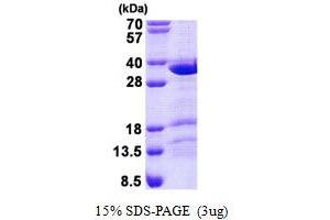 Coiled-Coil Domain Containing 43 (CCDC43) (AA 1-224) protein (His tag)