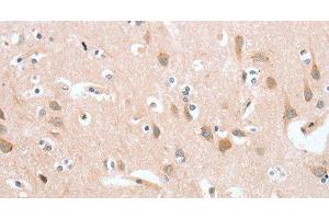 Immunohistochemistry of paraffin-embedded Human brain tissue using cPLA2 Polyclonal Antibody at dilution 1:40 (PLA2G4A 抗体)