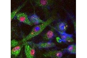 SY5Y cells stained for endogenous PARK8 (green), phosphorylated Tau (red), and DAPI nuclear staining. (LRRK2 抗体  (AA 930-961))