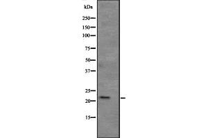 Western blot analysis of APR3 expression in human kidney tissue lysate ,The lane on the left is treated with the antigen-specific peptide. (ATRAID 抗体  (Internal Region))