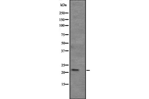 ATRAID 抗体  (Internal Region)