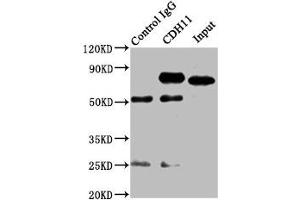 Immunoprecipitating CDH11 in SH-SY5Y whole cell lysate Lane 1: Rabbit control IgG instead of ABIN7146201 in SH-SY5Y whole cell lysate. (OB Cadherin 抗体  (AA 637-796))