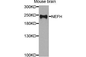 Western blot analysis of extracts of mouse brain cells, using NEFH antibody.