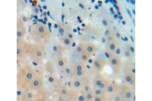 IHC-P analysis of liver tissue, with DAB staining. (C9 抗体  (AA 136-512))