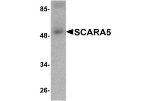 Western Blotting (WB) image for anti-Scavenger Receptor Class A, Member 5 (SCARA5) (C-Term) antibody (ABIN1030645) (SCARA5 抗体  (C-Term))