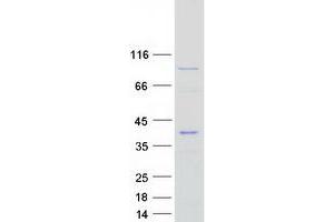 Western Blotting (WB) image for Epithelial Stromal Interaction 1 (Breast) (EPSTI1) (Transcript Variant 2) protein (Myc-DYKDDDDK Tag) (ABIN2720358)