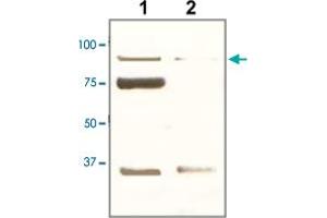 The tissue lysate derived from mouse kidney was immunoprobed by POU2F1 polyclonal antibody  at 1 : 500. (POU2F1 抗体  (C-Term))