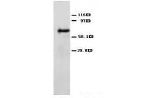 Western blot analysis of rat brain tissue lysis using ANG2 antibody (Angiopoietin 2 抗体  (C-Term))