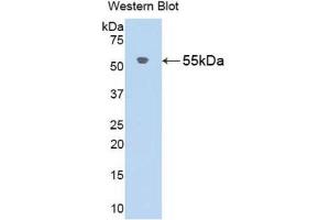 Western Blotting (WB) image for anti-Angiotensinogen (serpin Peptidase Inhibitor, Clade A, Member 8) (AGT) (AA 25-477) antibody (ABIN1857948) (AGT 抗体  (AA 25-477))